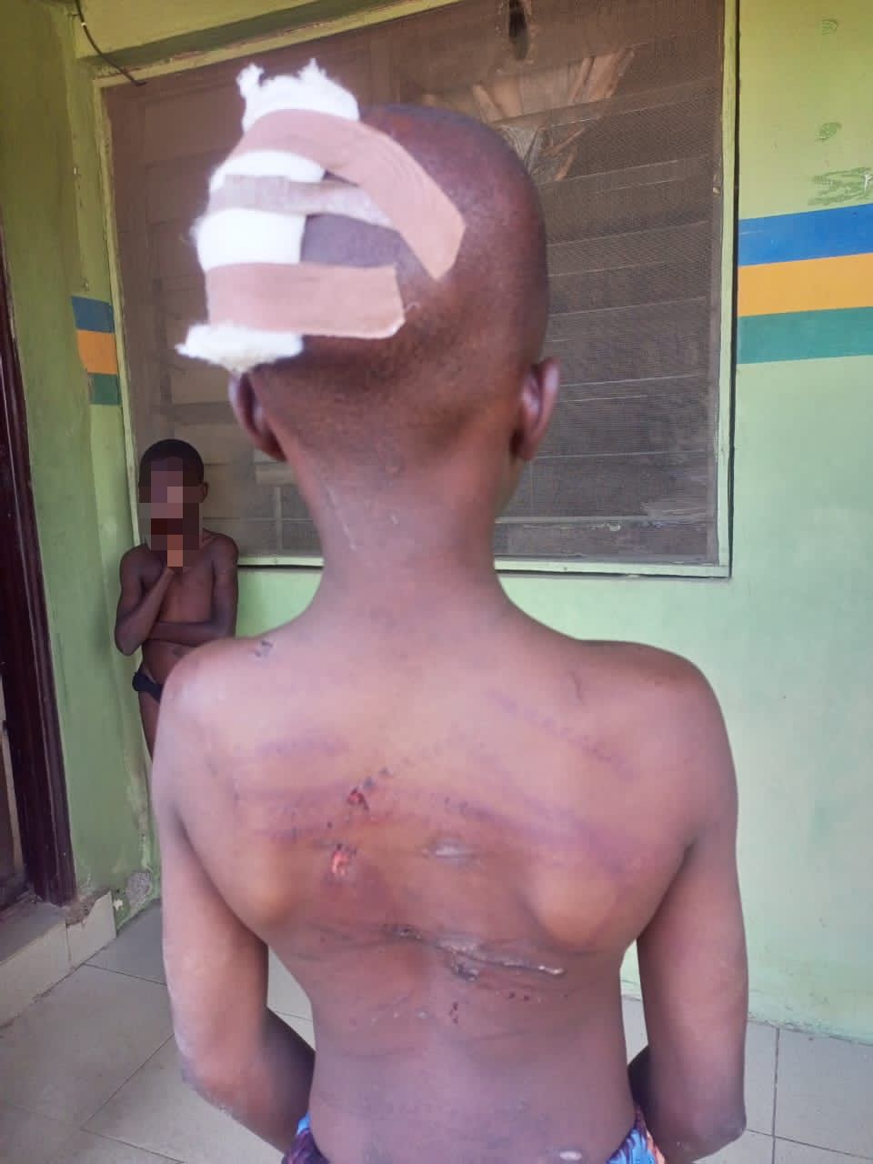 injured girl
